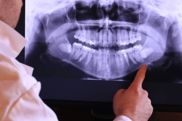 Best Urgent Tooth Repair  in Crugers, NY